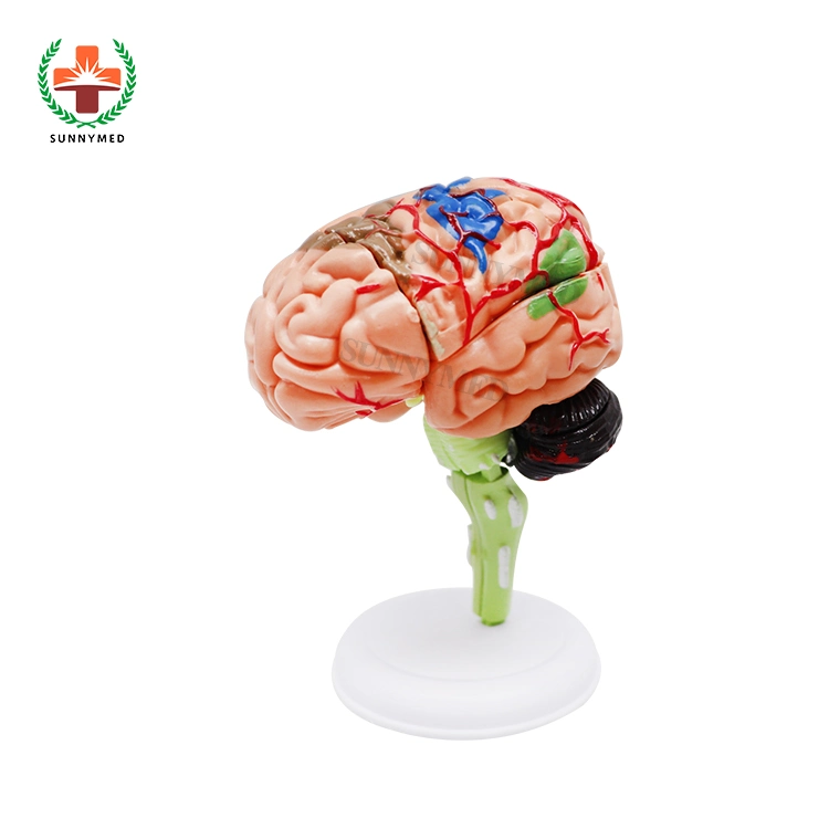 Sectioned Head and Face Anatomy Teaching Brain Head Model