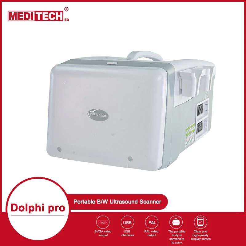 MEDITECH Laptop Ultrasound Scanner MD2100 con pantalla de 10 pulgadas CE Compatible con ISO