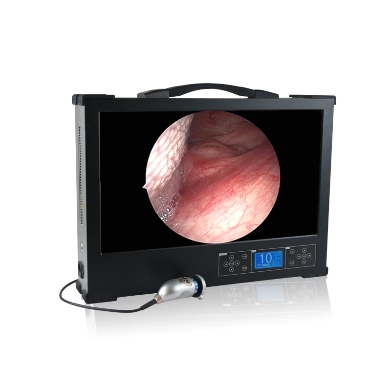 24 Inches Portable Laparoscopy Camera System