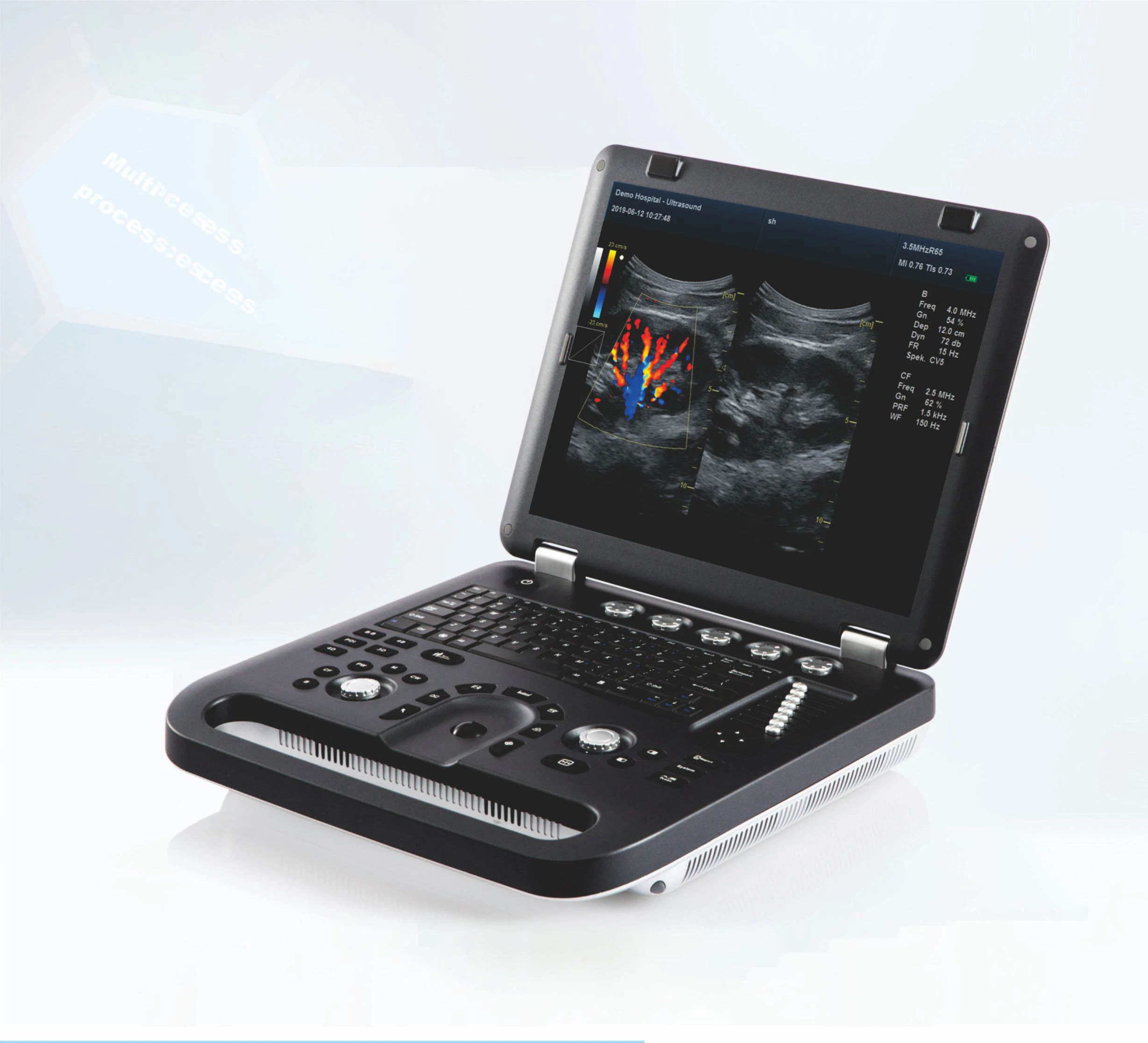 Portable 4D Baby Fetal Color Doppler Ultrasound Scanner From China