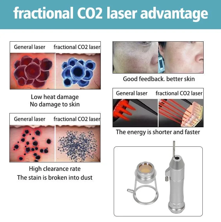 Fraction de CO2 laser peau retrait soin de la peau serrage de la machine de beauté Laser fractionnel RF CO2