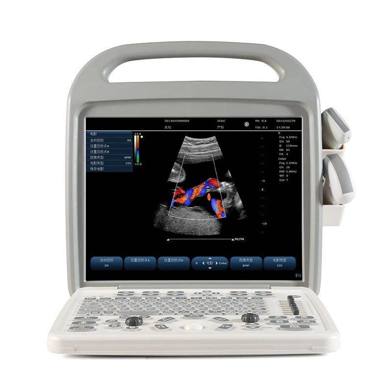 Maya de alta resolución de 15 pulgadas portátil Médica Digital 2D del Sistema de ultrasonido Doppler Color B Ecógrafo