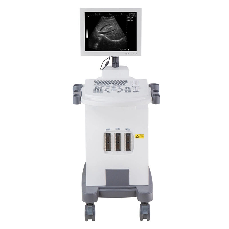 Высококачественный сканер Mecanmed 4D Machine Medical Equipment Doppler Ultrasound С тележкой