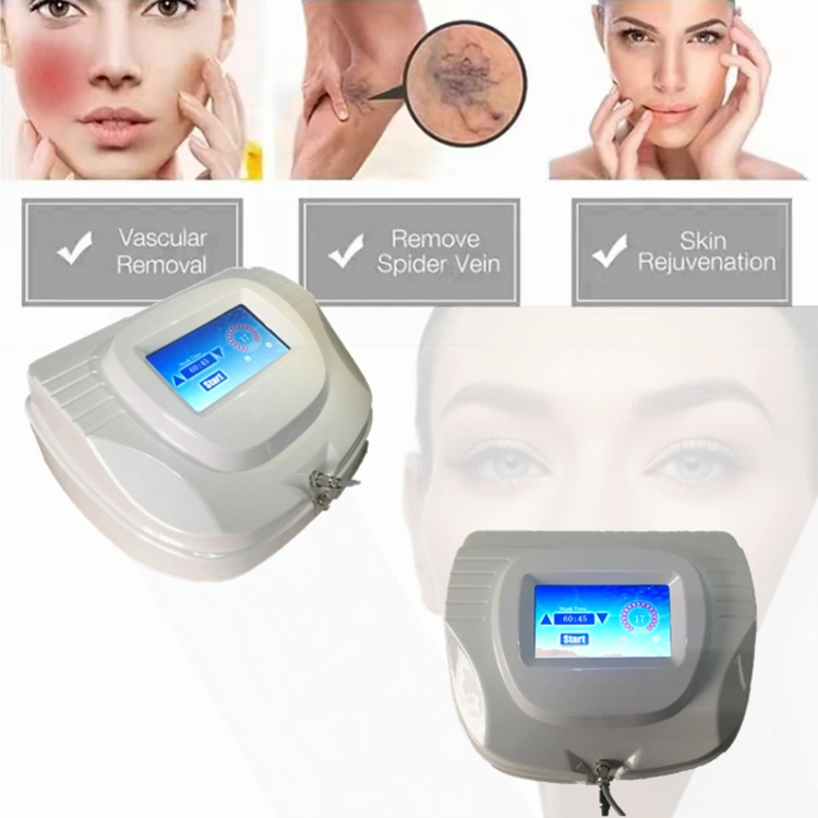 Significant Effect Rbs Vascular Removal Spider Vein Removal Spots Reduction Blood Vessels Removal Laser Machine