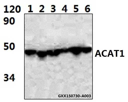 CE, la norme ISO9001 a approuvé l'Acat1 (K266) anticorps polyclonal