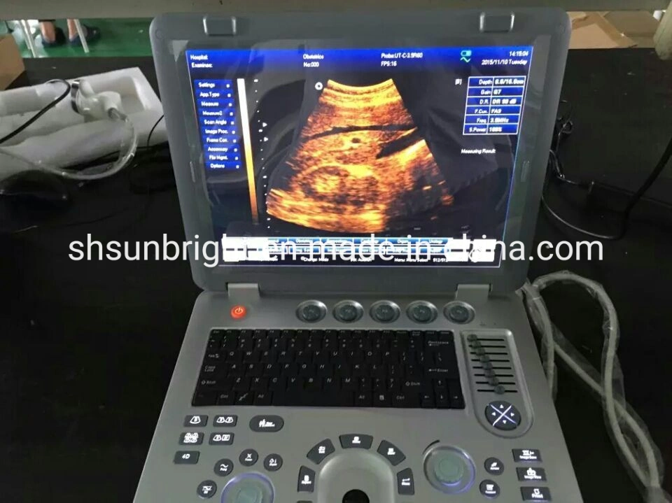 15" LED Screen High Resolution Portable 3D Ultrasound