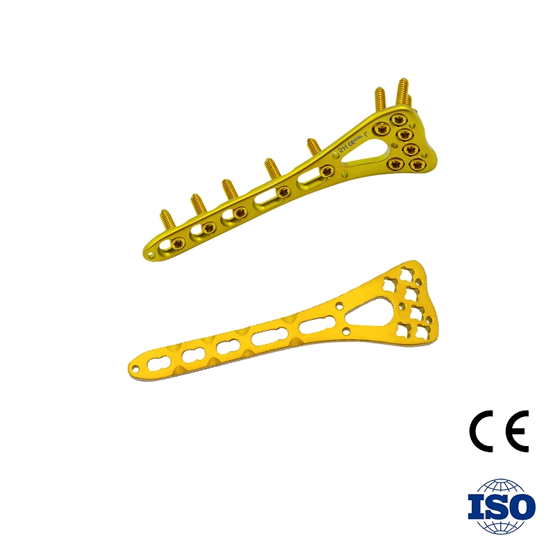 Factory Direct Sales for Multi-Axial Distal Radius Medial Locking Plates Set Price