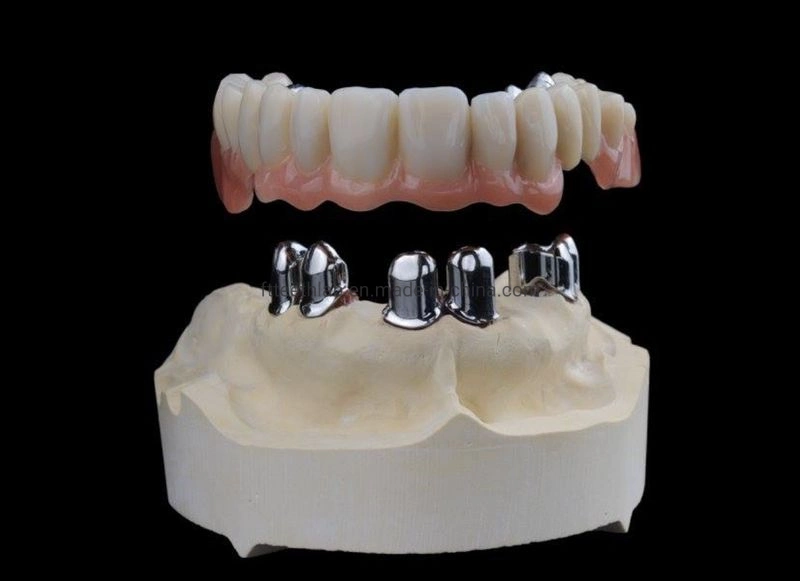 Telescópio removível dentaduras parcial fundido metal fabricado na China Laboratório de medicina dentária