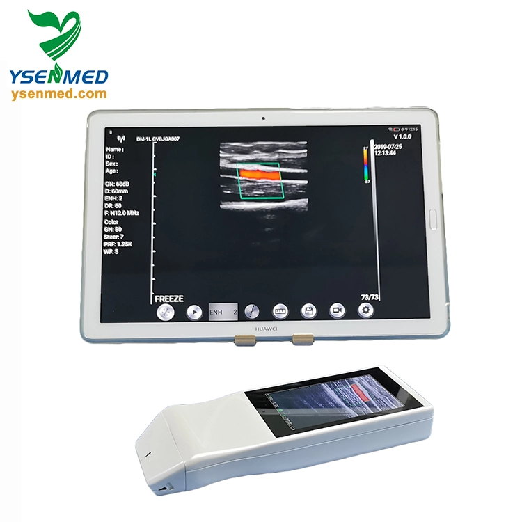 Medical Equipment Ysb-V5p Wireless Color Doppler Probe Ultrasound Medical Equipment