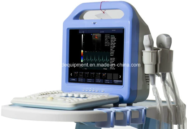 Color Doppler Medical Equipment 2D 3D 4D Portable Ultrasound Scanner (7 Models for your Choice)