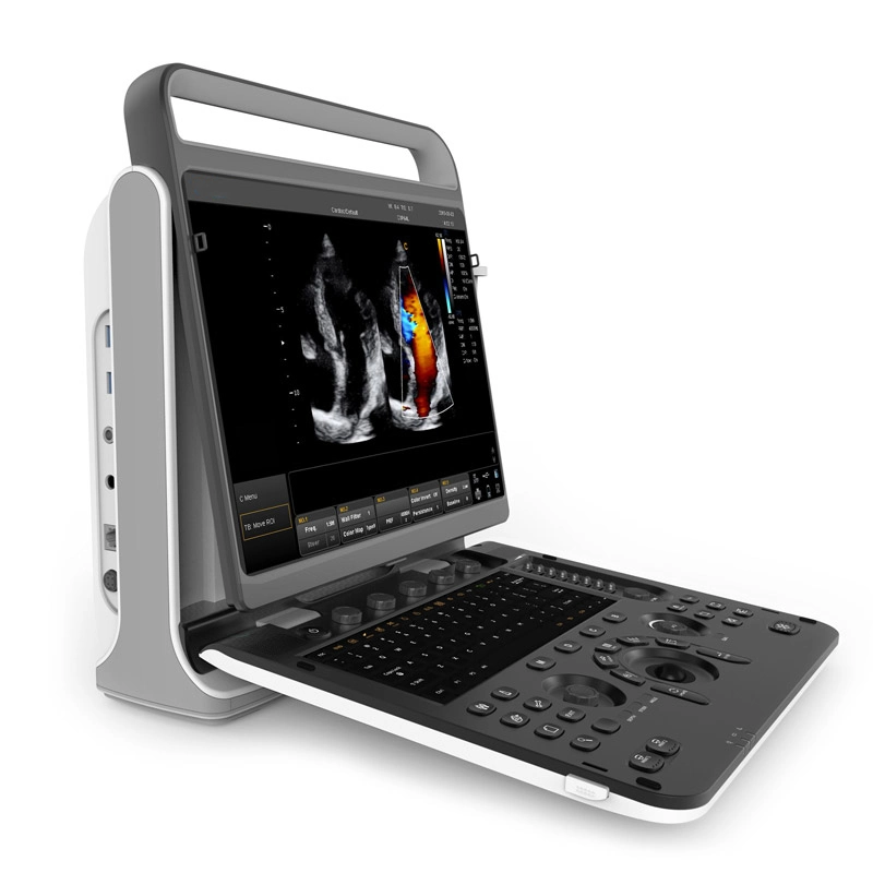 Chison Ebit50 4D 5D Portable Color Doppler Digital Dianostic Imaging System Human Ultrasound Gynecology, Cardiovascular Echo Machine