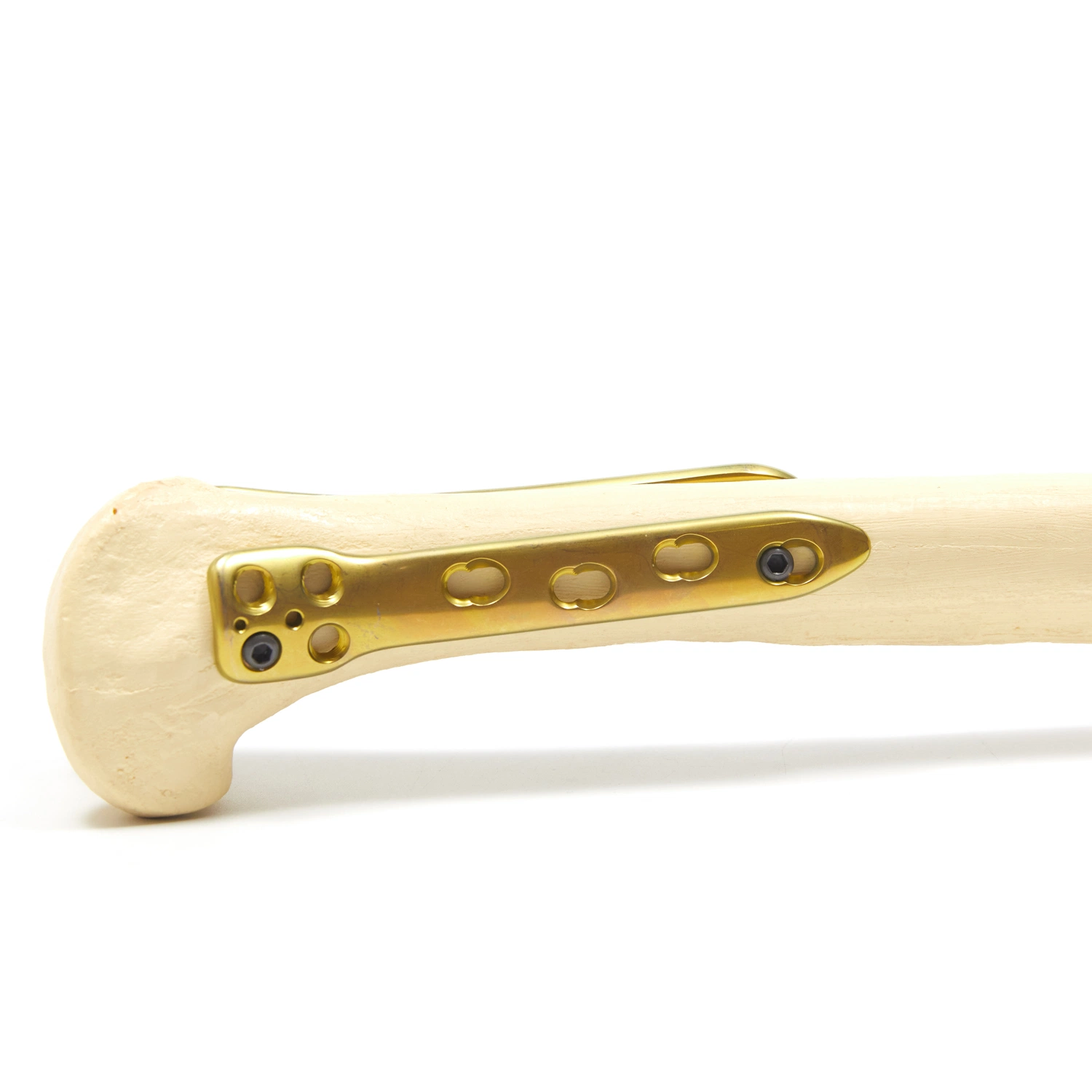 Medical Orthopaedic 5,0 Osteotomie Verriegelungsplatten Instrumentensatz