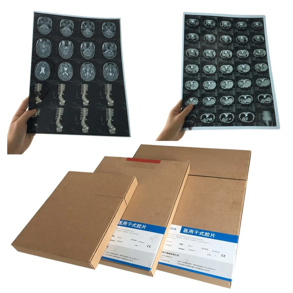 Blue Color Medical 18*24 Cm Inkjet X Ray Dry Film