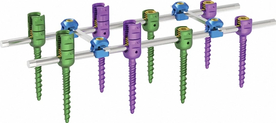 Médico implante ortopédico Jinlu doble núcleo del sistema de la columna vertebral y el doble de tipo de rosca que se puede romper Polyaxial tornillos pediculares 745