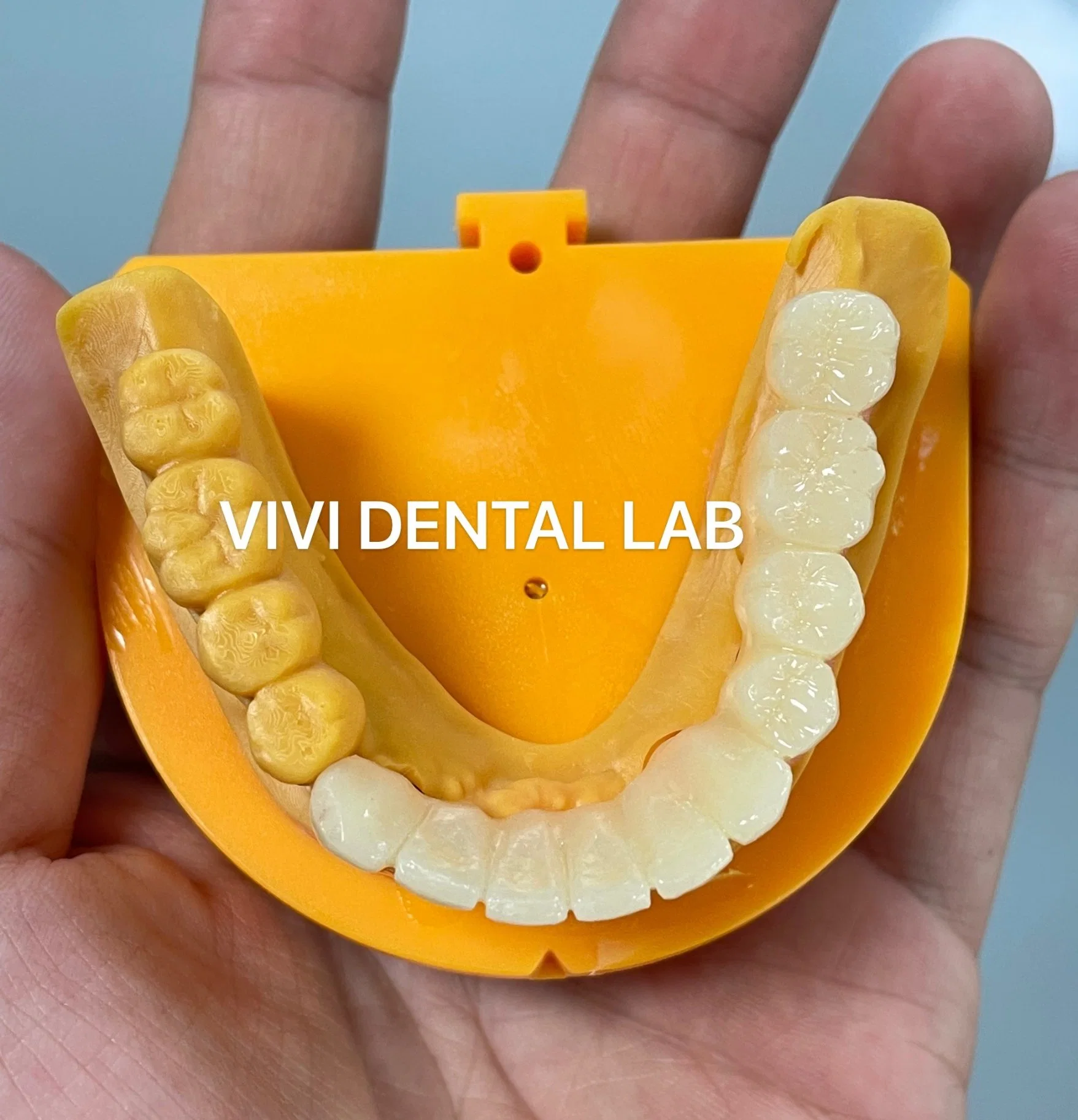 Temporary Crown - China Dental Lab Dental Crown in Good Quality and Good Esthetics