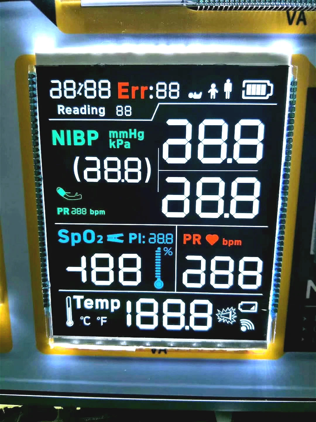 Custom bon segment de couleur à contraste élevé va Display LCD pour les produits électroniques