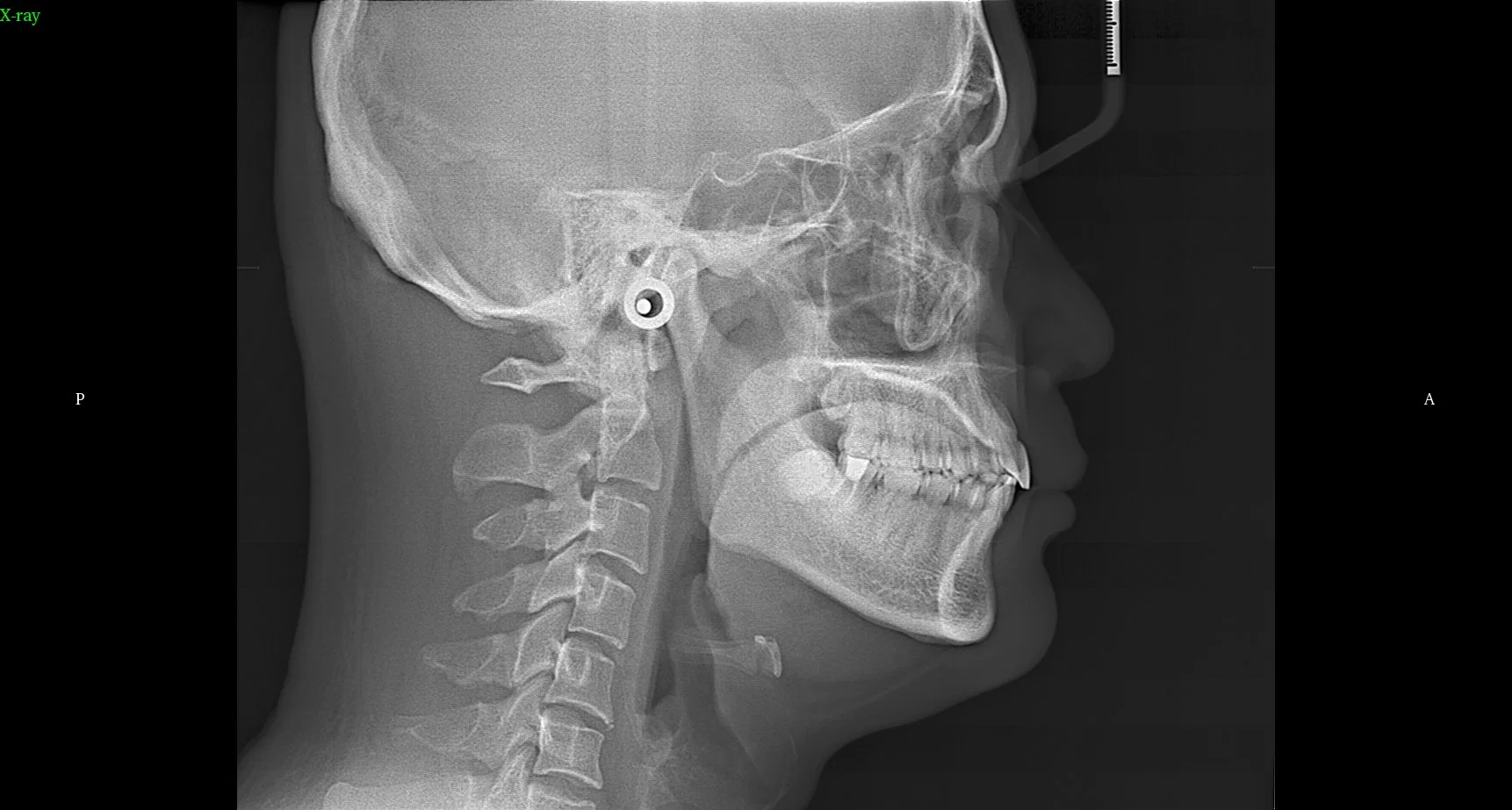 Cheap Price 3D Dental Cbct X Ray Machine with Ceph for Hospital Dental Clinic