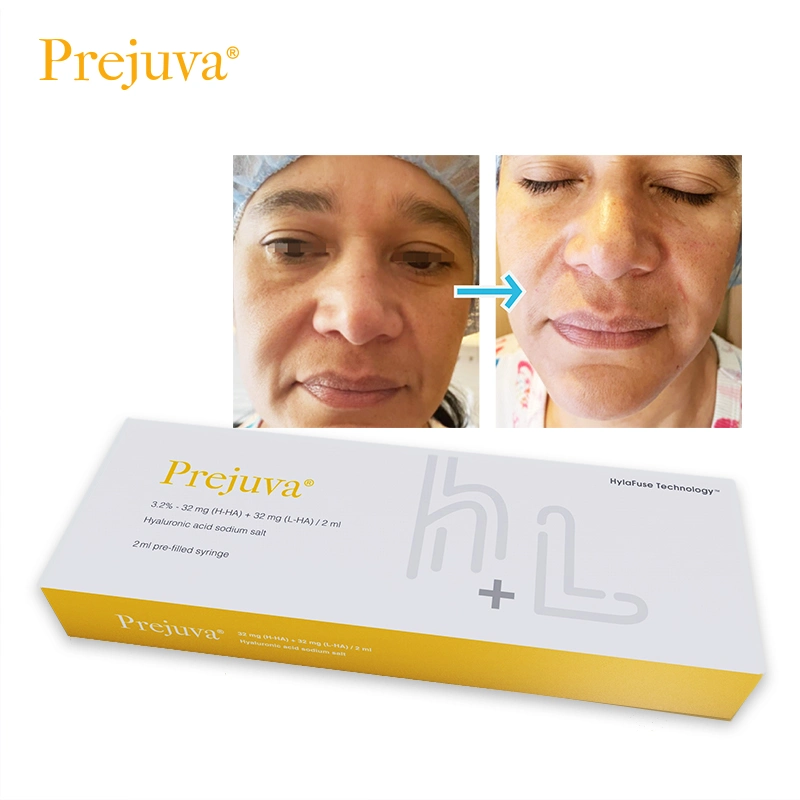 Prejuva 2ml mejore el cuidado de la piel Anti-Aging Prohilo Anti-arrugas cara de suero Elevación del relleno dermal H L