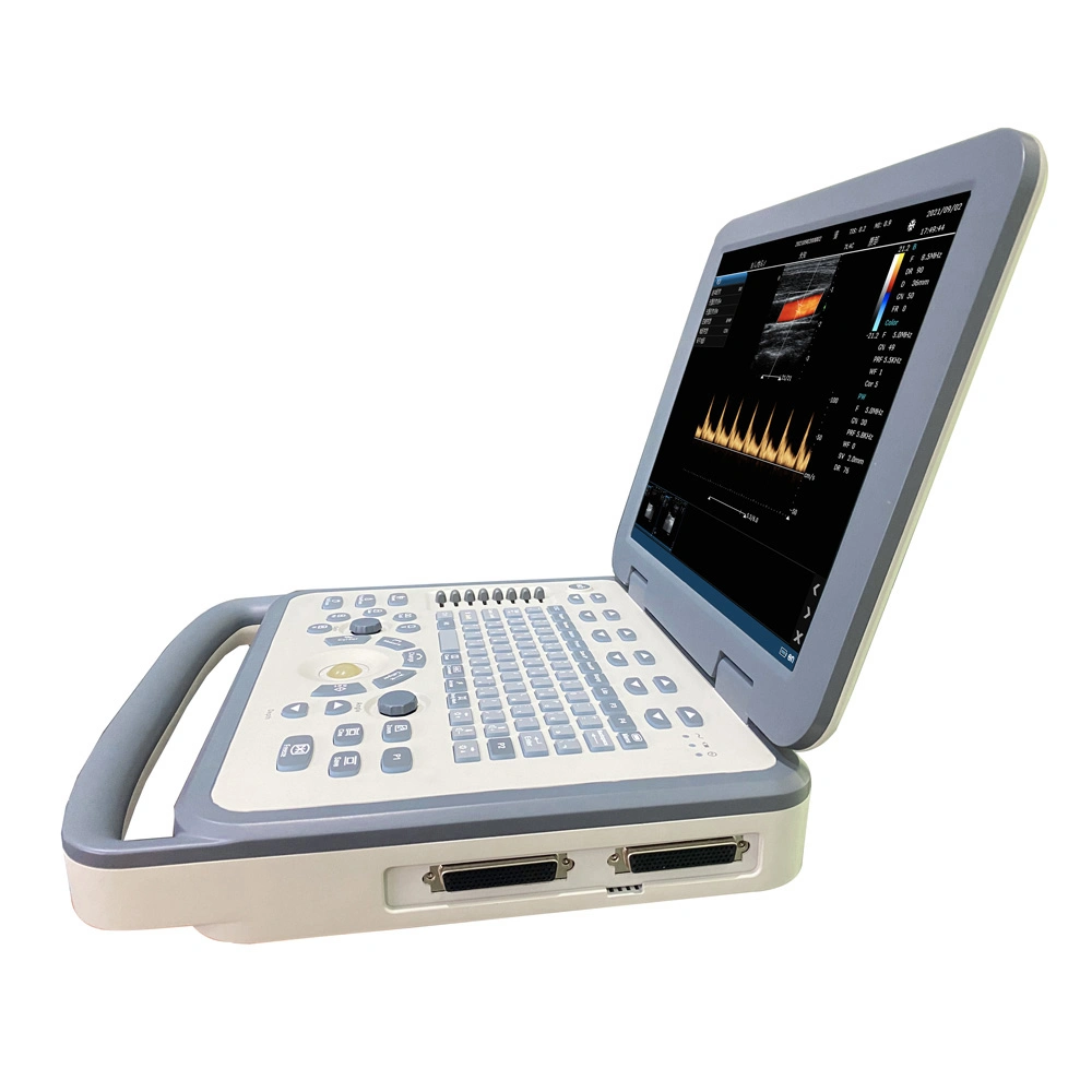 Icen New Medical Wireless Color Ultrasound Machine Portable Obstetric Ultrasonic Echocardiography Machine