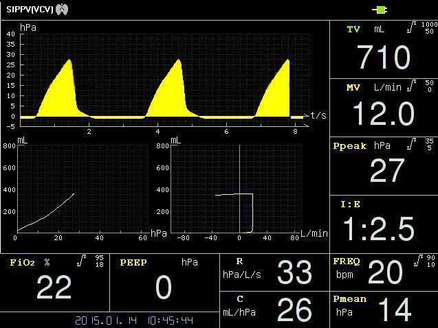 جهاز تهوية الجهاز التنفسي للمصنع جهاز تهوية صحية من نوع ICU PA-900b مع شاشة TFT LCD ملونة بحجم 10.4 بوصة Display (شاشة العرض