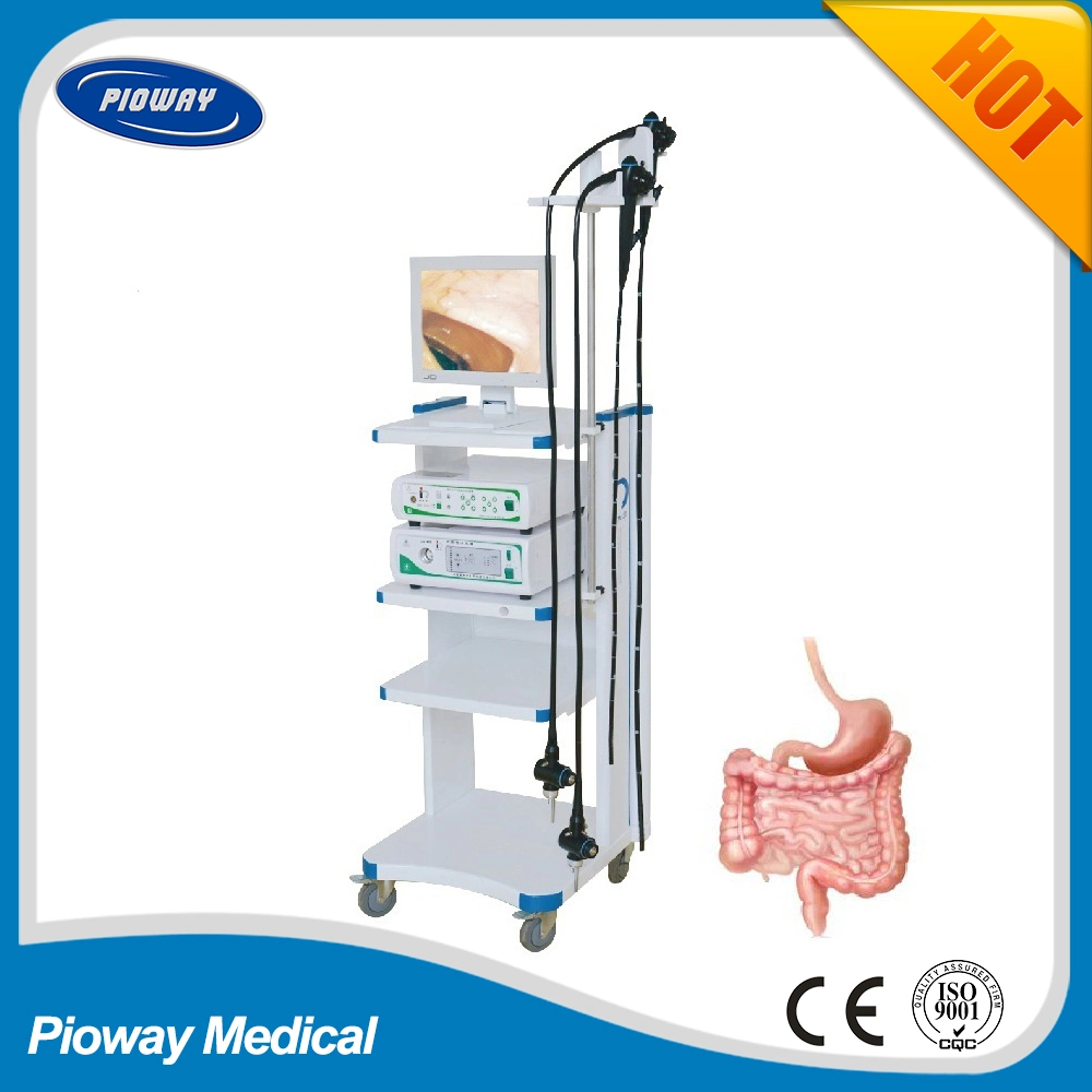 China Flexible Endoscopy System Video Gastroscope and Colonoscope (Standard Option)