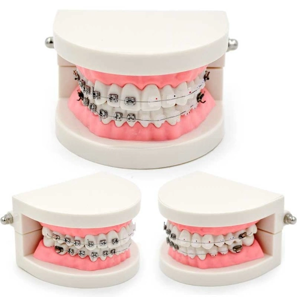 Modelo de dientes Dental Ortodoncia con el soporte del modelo de enseñanza para estudiantes