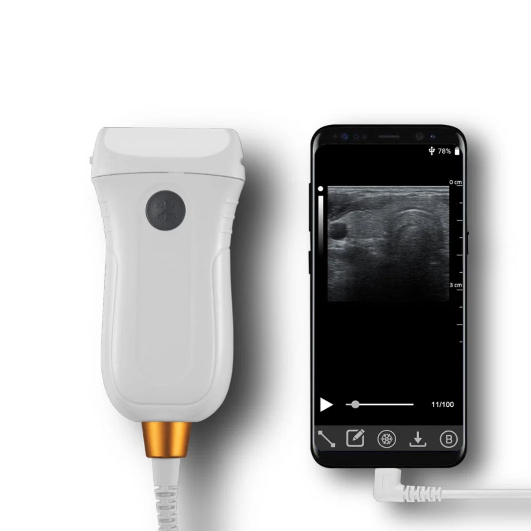 Mx5 B/W ultrasonido portátil para el ganado Ecógrafo veterinario