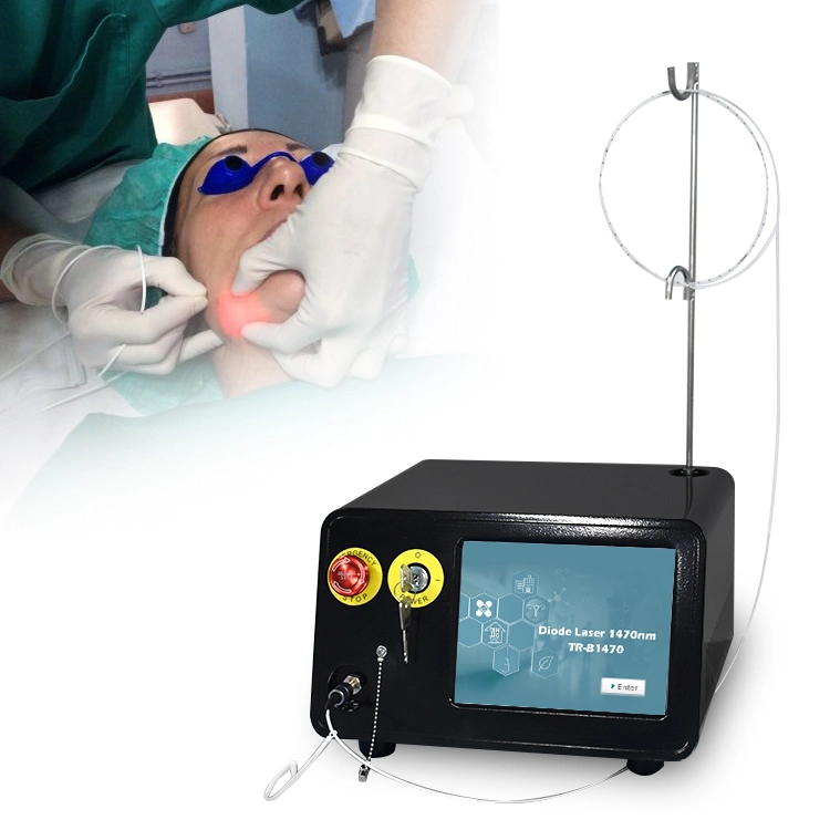 2024 Triangelaser poderoso 1470nm Diodo láser 12W Liposucción Cannula Belleza Equipo de Salón