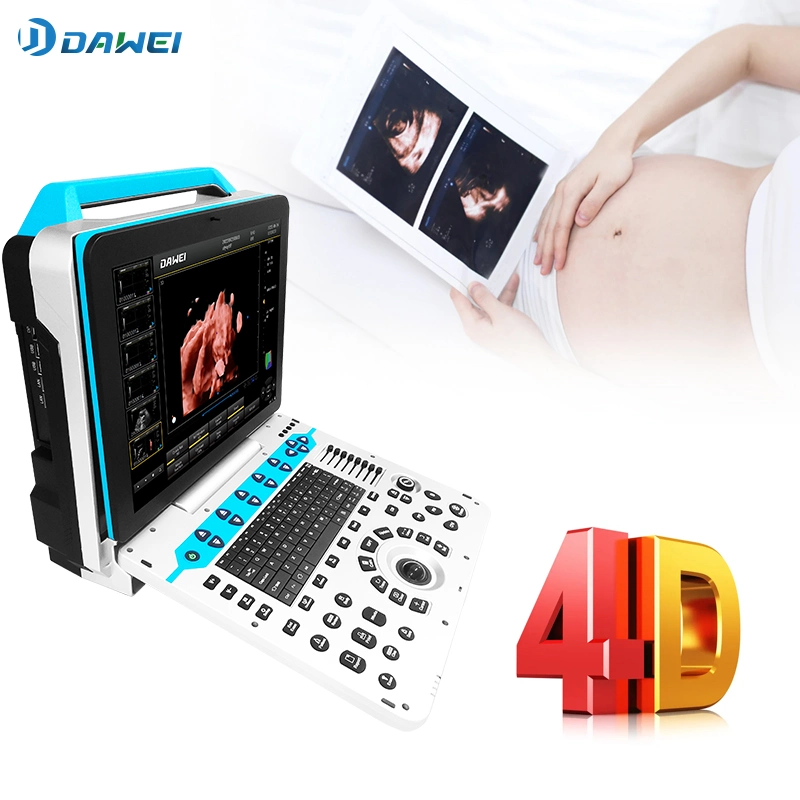 Dawei Dw-P30 Portable Abdominal Echography Doppler Color 3D 4D Ultrasound Echo Machine