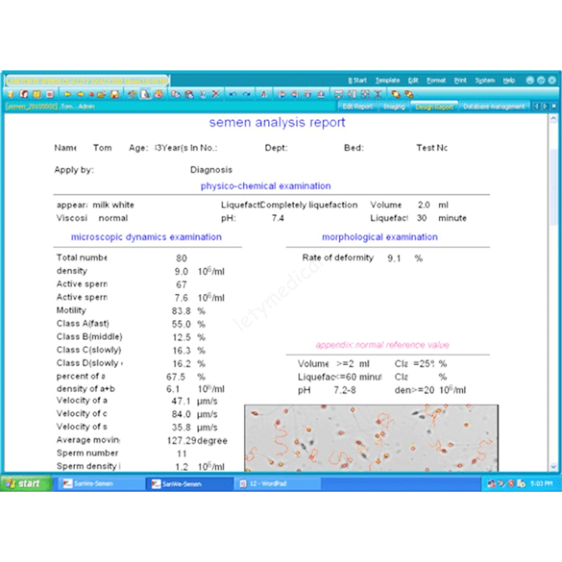 Sw-3703 Sperm Quality Analyzer Sperm Quality Microscope Andrology Workstation