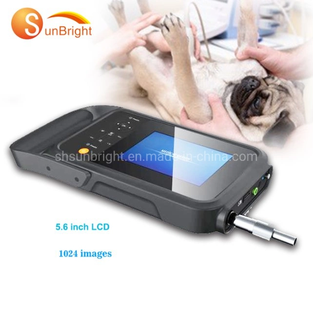 Vascular Ultrasound Machine Device Ob/Gyn Medical Ultrasound Price