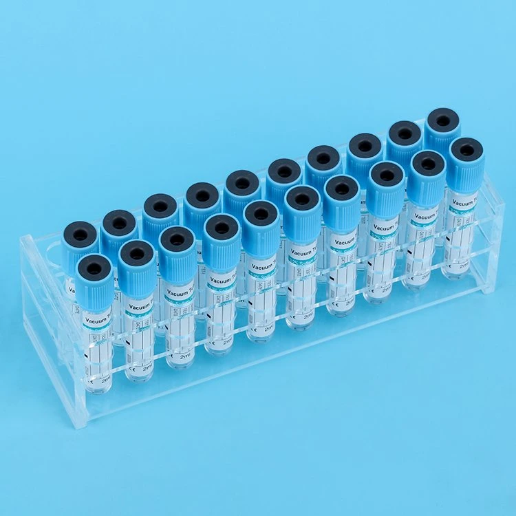 Cheap Disposable 2ml 3ml 4ml 5ml 10ml Non- Vacuum EDTA K2 K3 Pet Glass Blood Test Collection Tubes with China