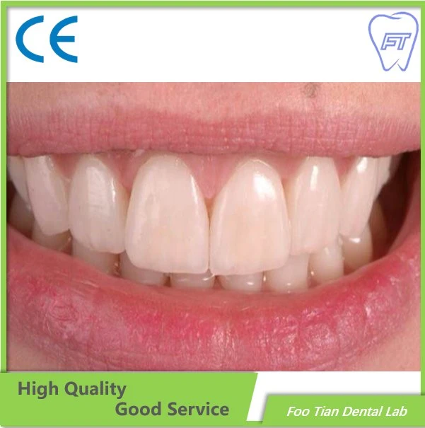 Dental Zirconium Bridges From China Dental Lab