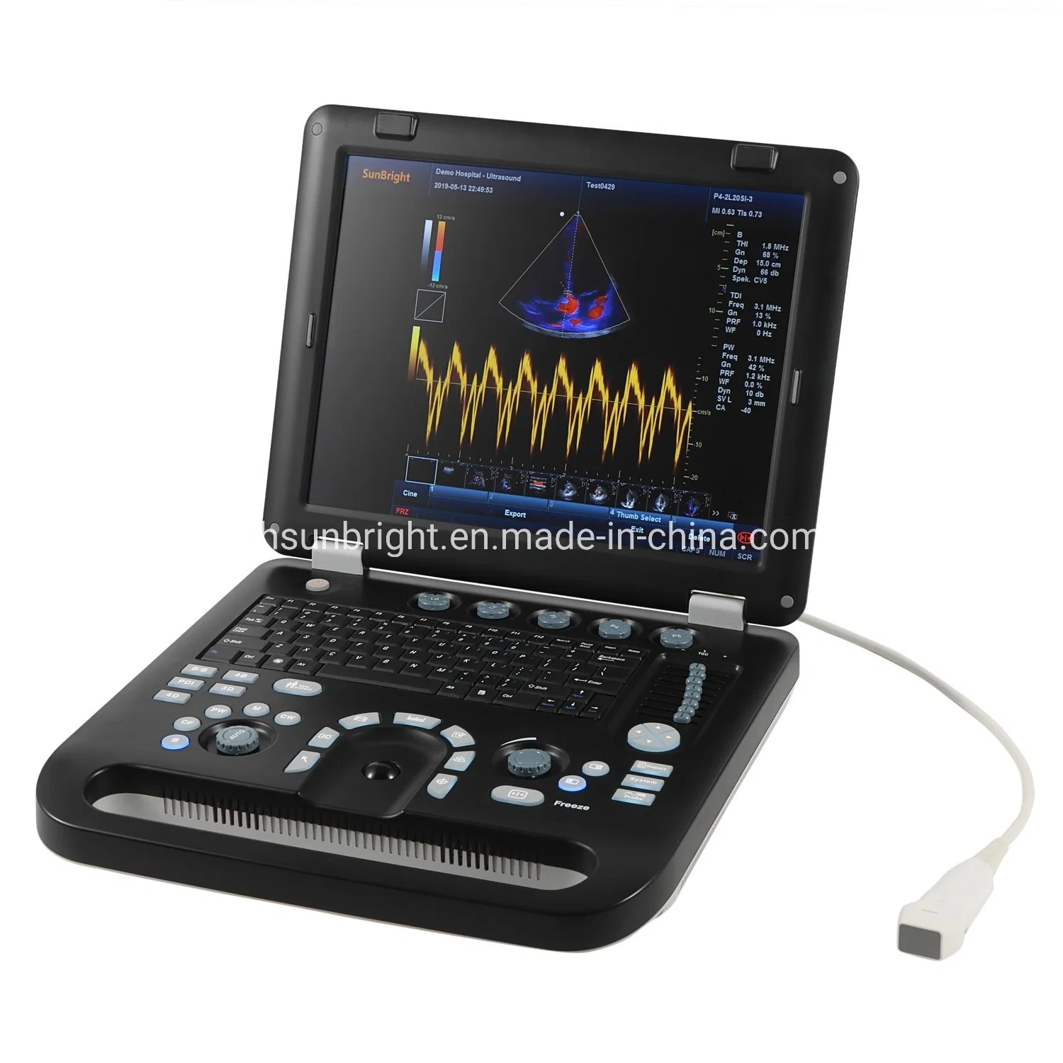 Ce Approved Portable Ultrasound Color Doppler Ultrasound Price Sun-906c 196 Elements