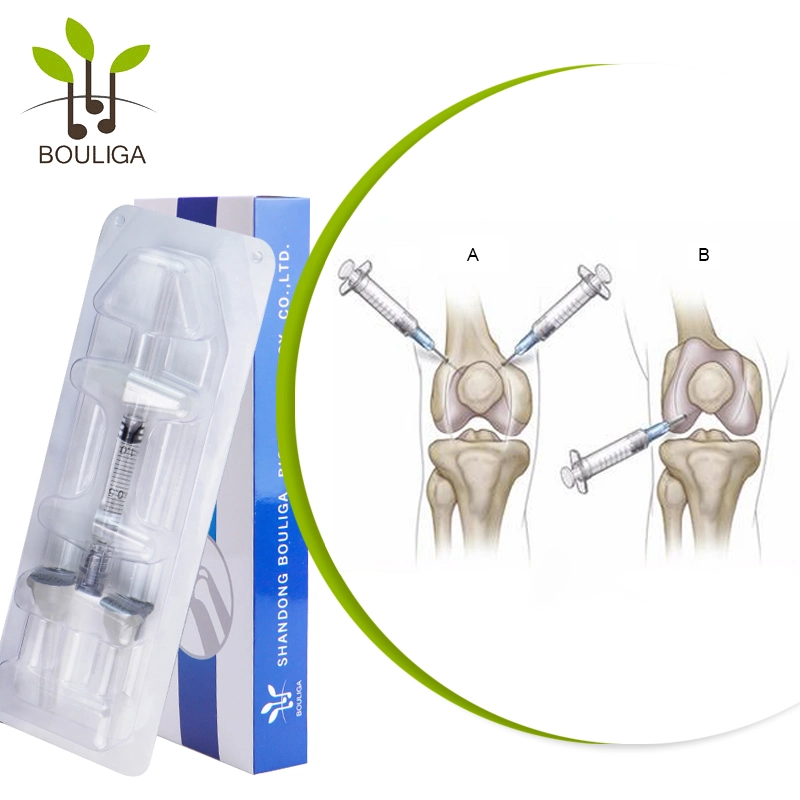 Ácido Hialurónico rodilla intraarticular Osteoartritis Inyección articular Llenador dérmico