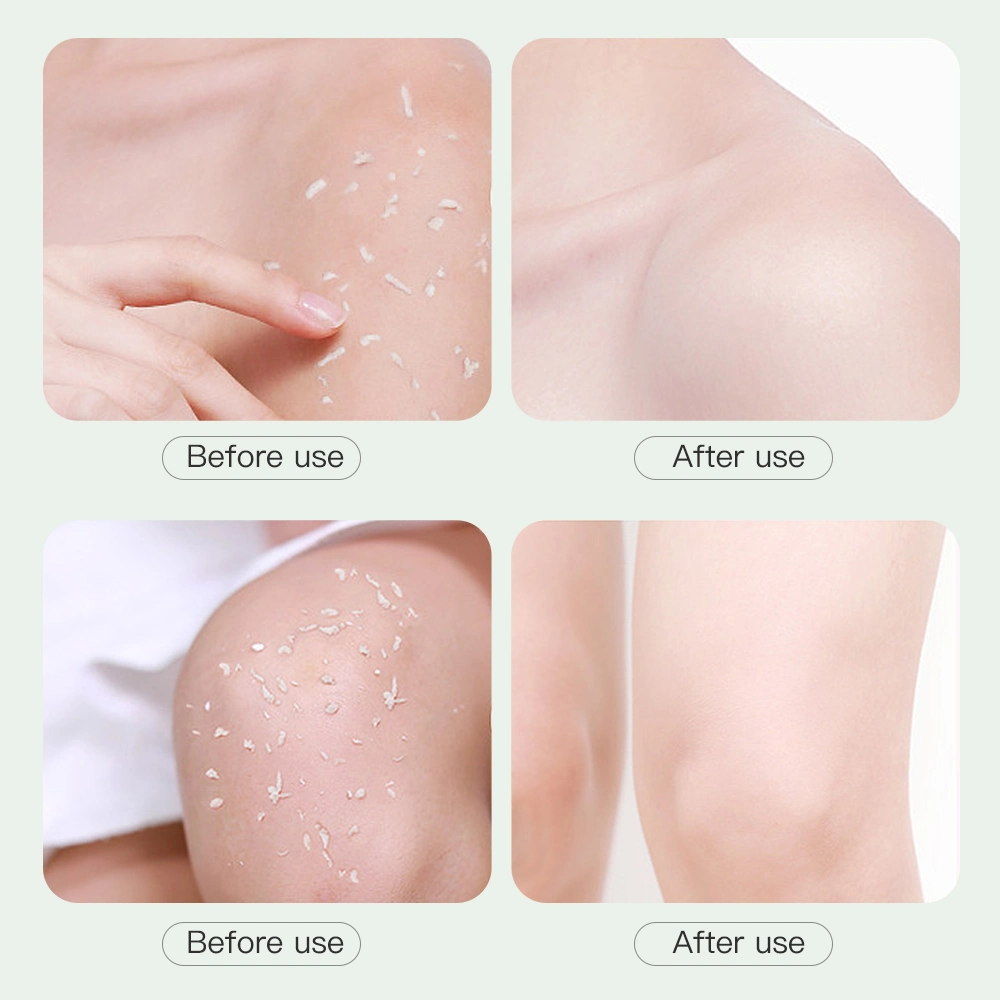 Exfoliating Body Scrub Gel Facial Peeling Gel Moisturizing Cream