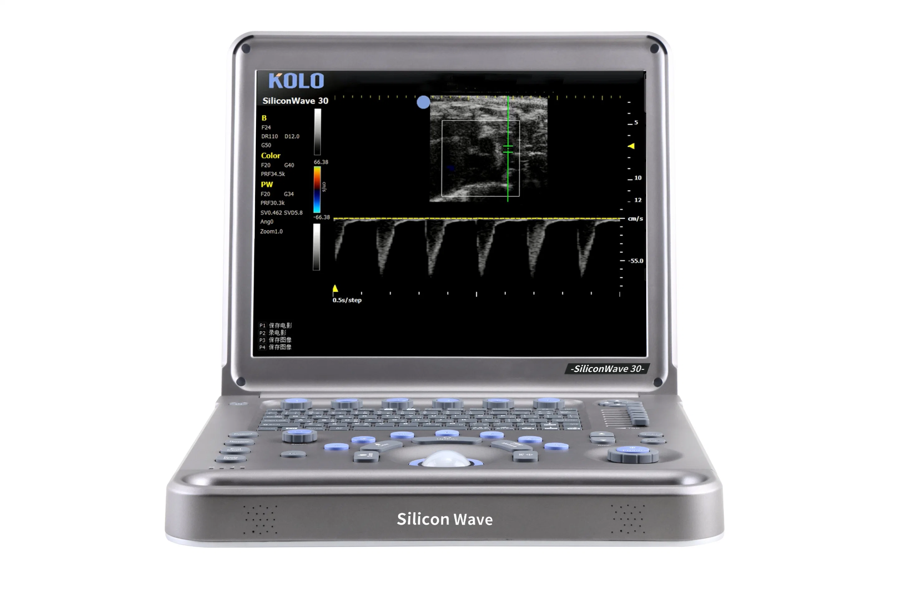 Kolo Siliconwave 30 Portable Ultrasound Scanner for Laboratory Animal
