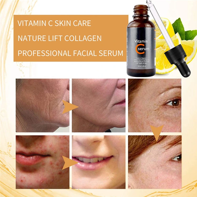 OEM Firmador Hidratante vitamina C Face séricos essência produto dermatológico