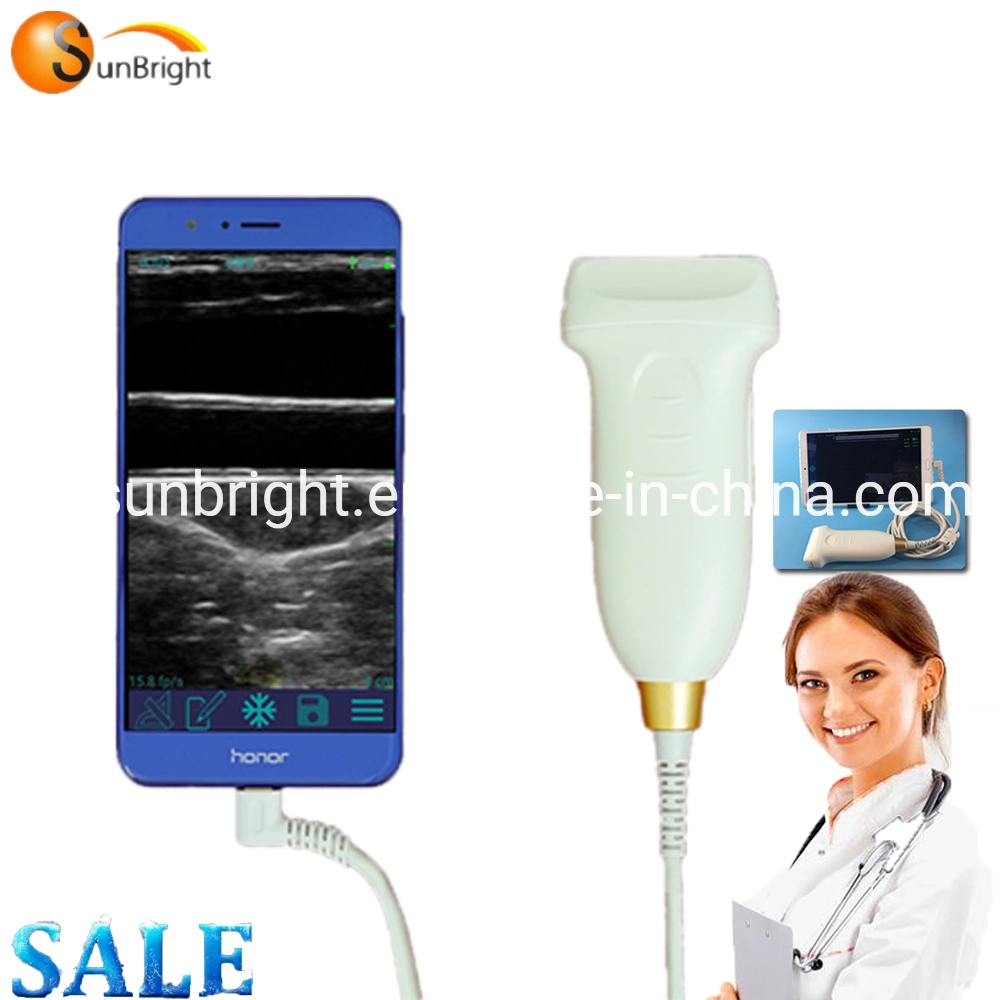 Professional Test Vascular Pocket Ultrasound Machine USB Probe