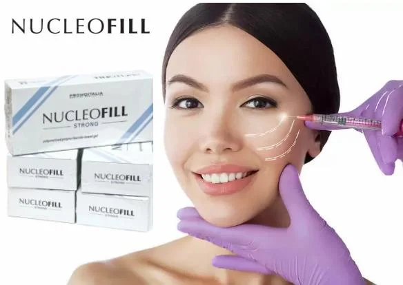 Nucleofill Strong Promoitalia Bio-Revitalization 7 Point 5 Point Lifting Technology Polymerised Polynucleotides-Based Gel for Skin Collagen Stimulation