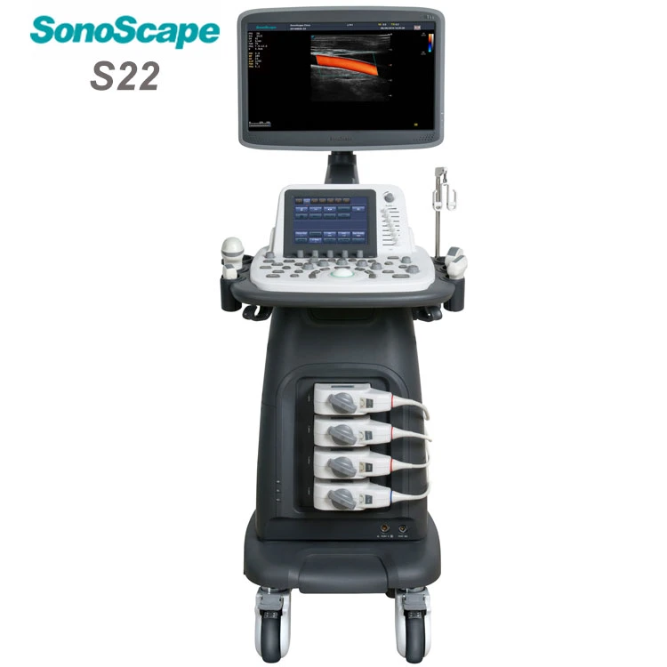 Mobile 4D Trolley Color Doppler Sonoscape S22 Ultrasound System with 8inchtouch Screen 18.5inch LCD