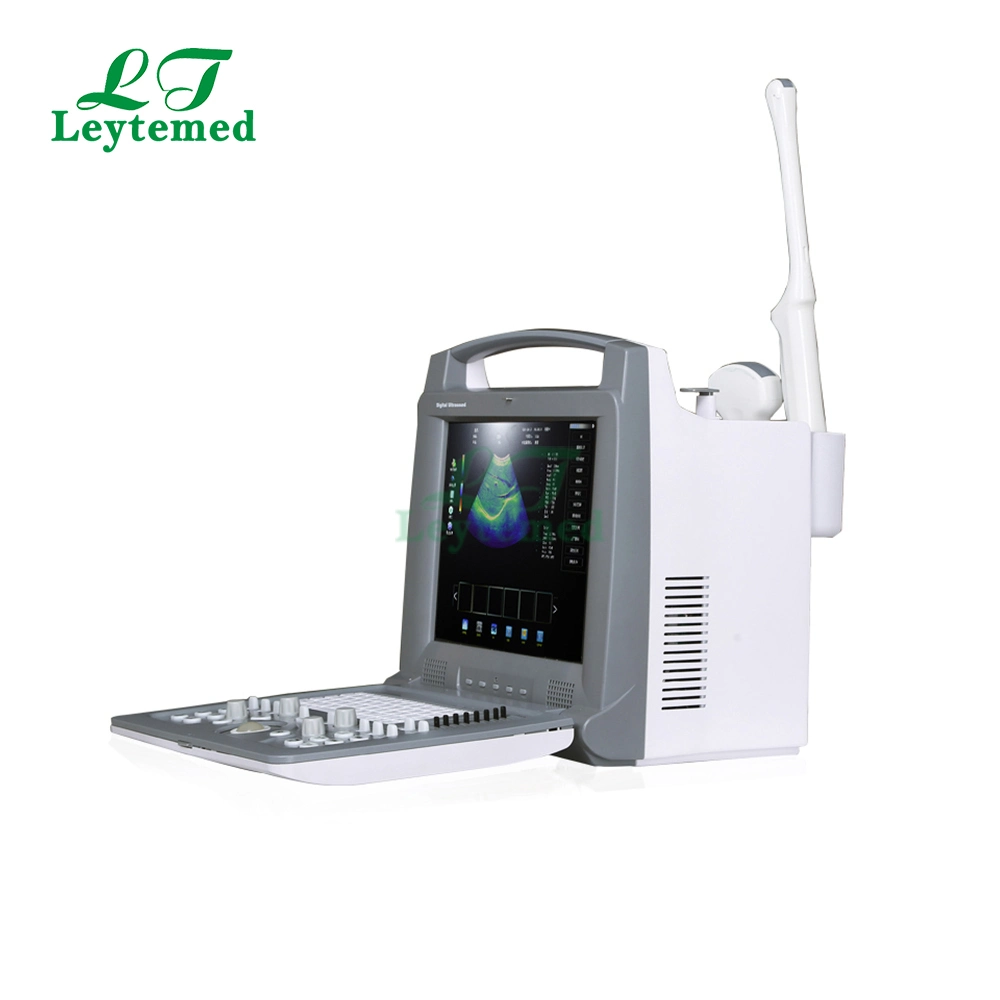 Ltub04 Digital Portable 3D Color Doppler Ultrasound Machine for Medical