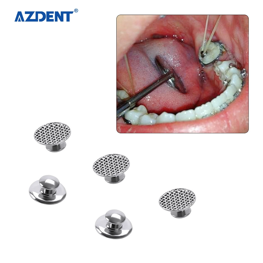 Hot Sale Azdent Dental Supplies Smoot Bondable Nيتحدث الأزرار (Round) 10 حزم/حقيبة