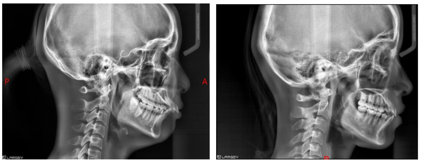 Smart 3D 2D Dental Hersteller Lieferant Digital Panoramic cephalometrisch CBCT Zahnärztliche Röntgengeräte für die zahnärztliche Diagnose mit CE-Zertifikat