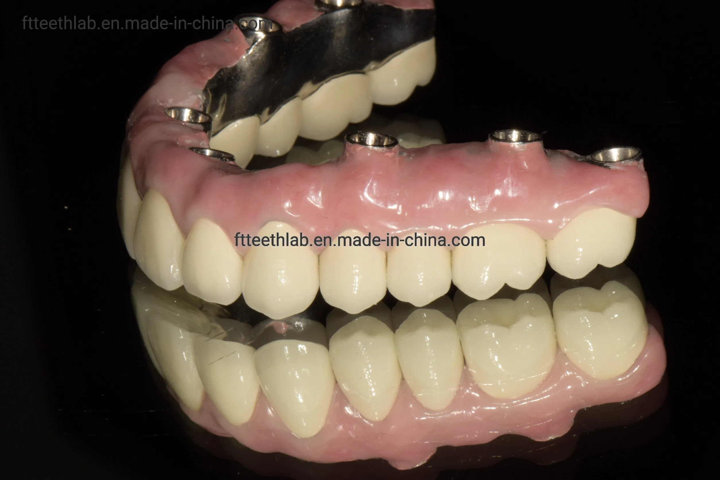 Full Arch Implant Bridge Made with 3D Scan Files Dental Implants