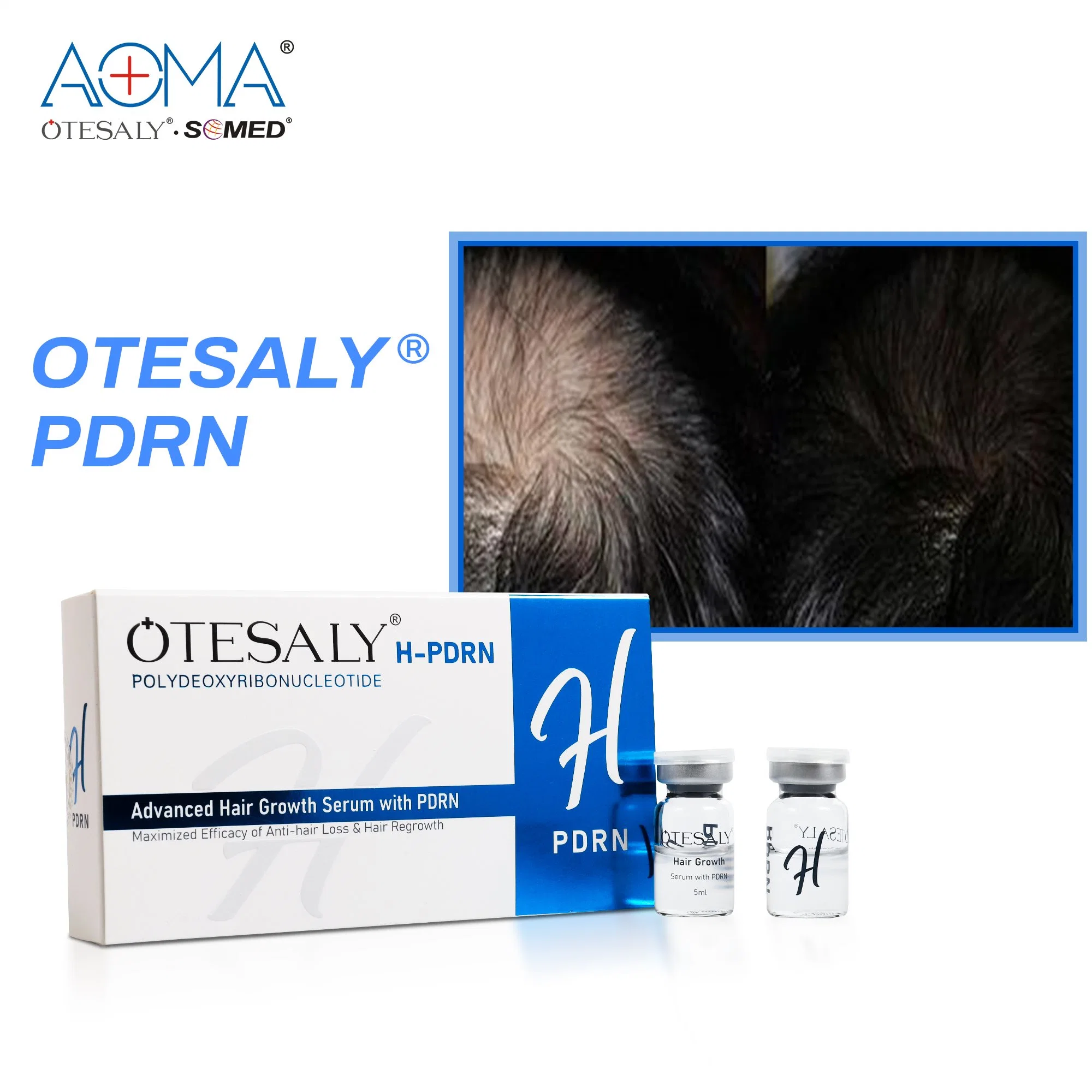 Otesaly Advanced Hair Growth Serum with Pdrn Hair Solution Anti Products Regrowth of Loss Serum Hair Growth Injection