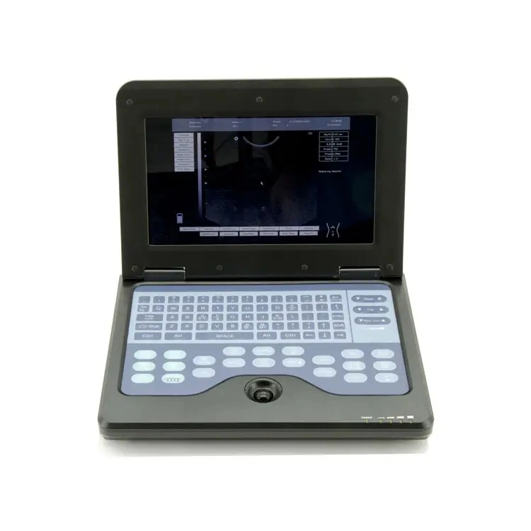 CE Approved Laptop Portable Digital B Ultrasound Diagnostic System Ultrasound Machine