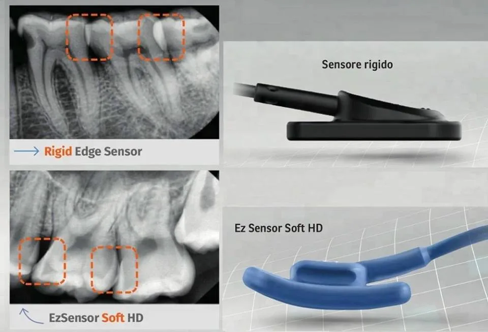 Vatech Dental Rvg Xray Ez Sensor Original Korea Intra Oral Imaging System