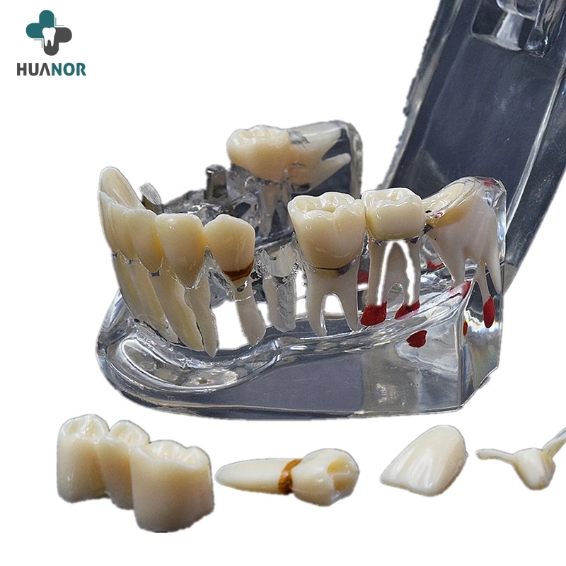 Dentista médico modelo de Anatomia Dental Modelo Dente estudo 32 dentes Modelo com Base