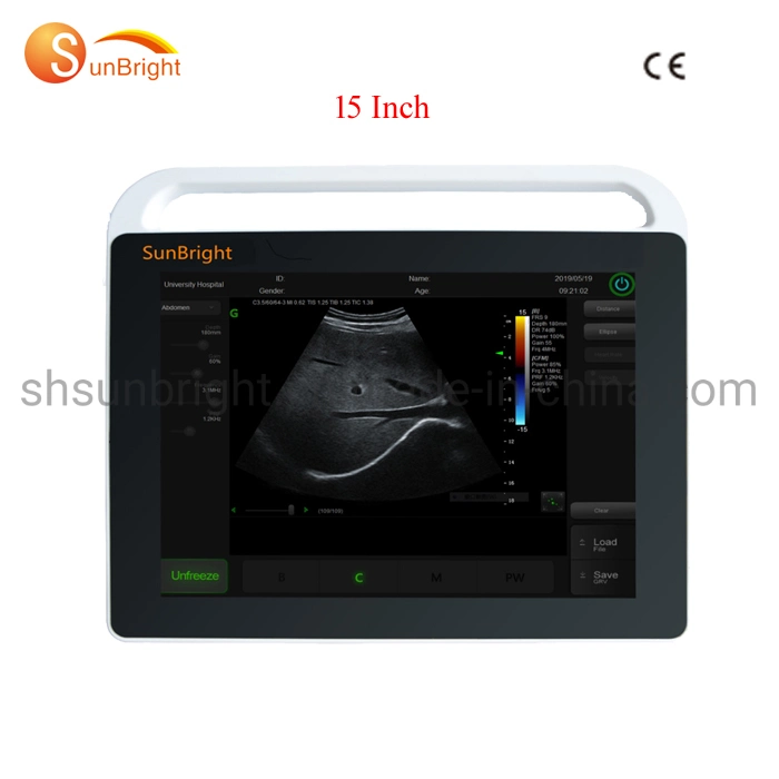 Sunbright Doppler Ultrasound Scanner Pantalla táctil de 15 pulgadas Equipo portátil de ultrasonido LED